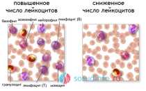 Понижение количества лейкоцитов в крови