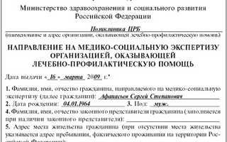 Инвалидность по астме у взрослых — пошаговая инструкция