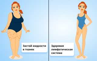 Важность чистки лимфы для здоровья