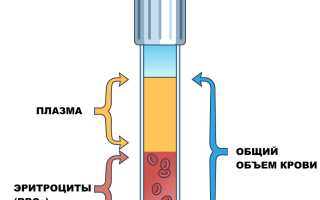 Полицитемическая гиперволемия — что это такое?