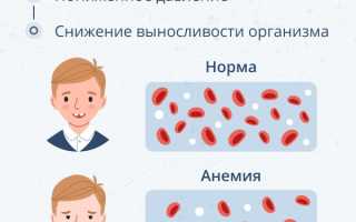 Анемия у младенца в 2 месяца — причины и симптомы