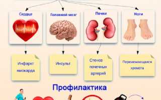 Коронарный атеросклероз — причины, симптомы и лечение