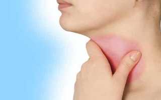 Лечение народными средствами щитовидных узлов