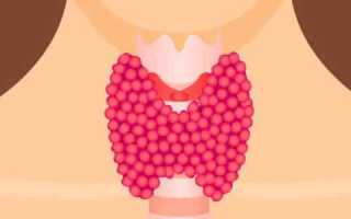 Диагностика и лечение узлового образования правой доли щитовидной железы