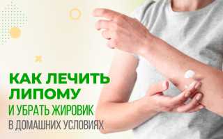 Удаление жировика на руке — домашние методы