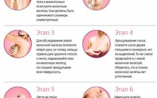 Инфильтрат молочной железы — что это и как распознать