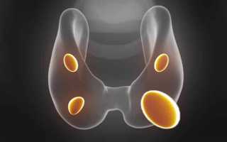 Что такое фолликулярная аденома щитовидной железы?