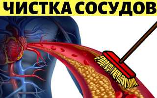 Очистка сосудов чесноком — простые и эффективные способы