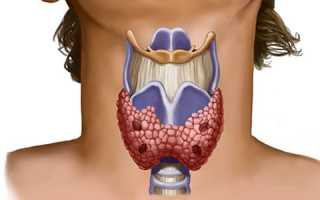 Причины и симптомы уплотнения щитовидной железы