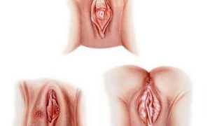 Язвы и ранки на половых губах