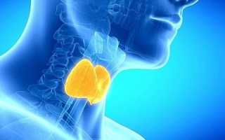 Что такое кальцинаты в щитовидной железе?