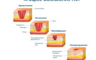 Быстрое заживление порезов от лезвия — эффективные методы