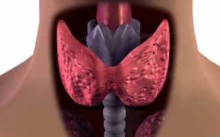 Симптомы и лечение избытка гормонов щитовидной железы