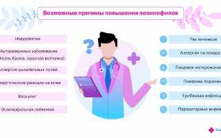 Эозинофилопения — причины, симптомы и лечение